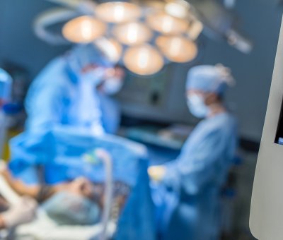 four doctors performing an operation in an operating room